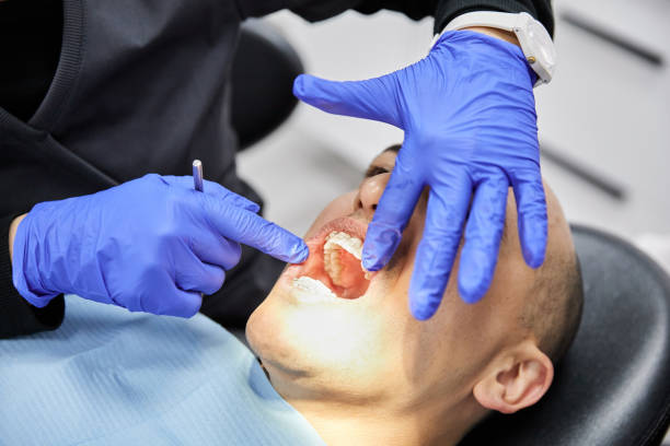 Best Emergency Dental Care for Broken or Chipped Teeth in Fairfield Glade, TN