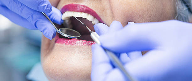 Best Emergency Treatment for Dental Infections or Abscesses in Fairfield Glade, TN